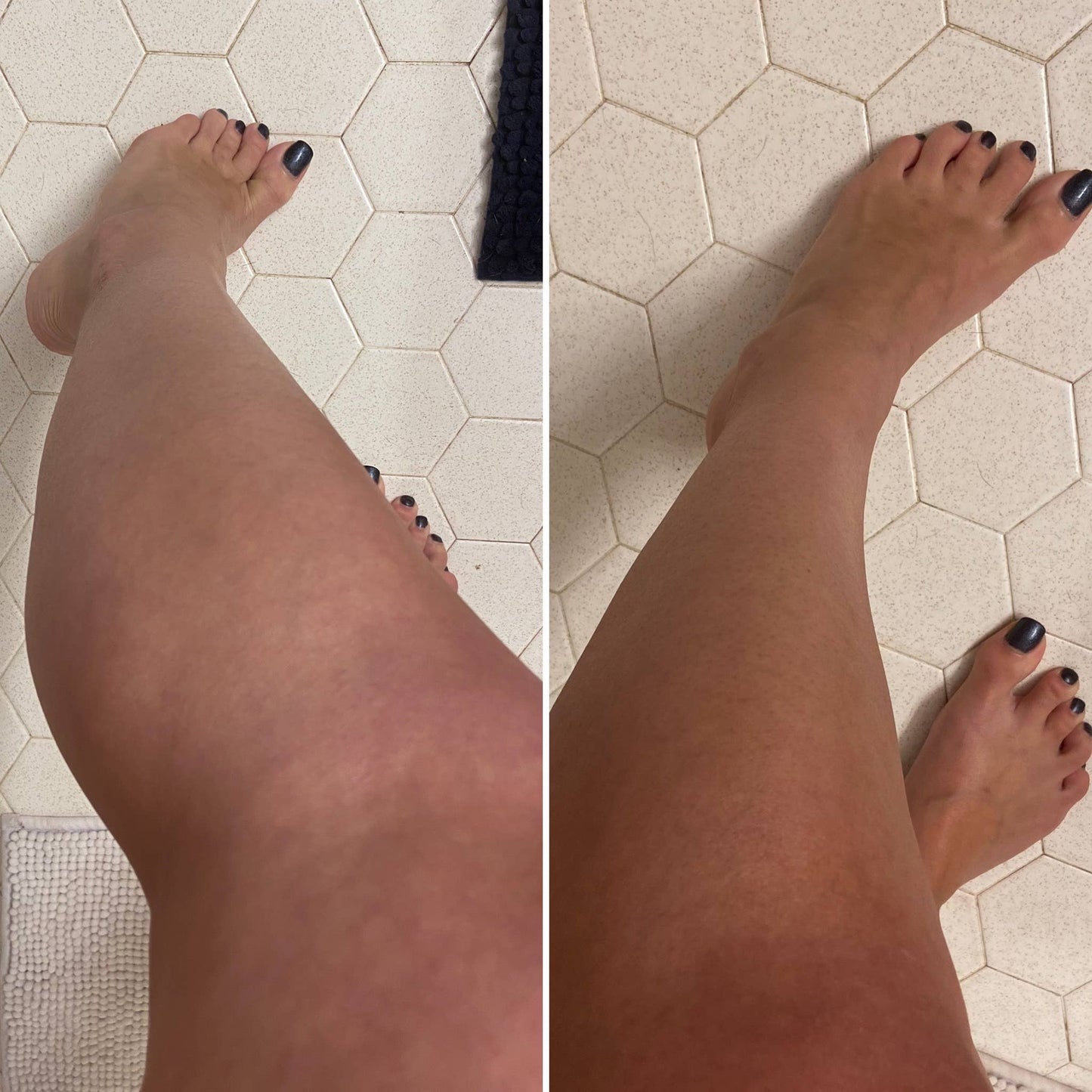 BEETTAN SELF-TANNER Lotion